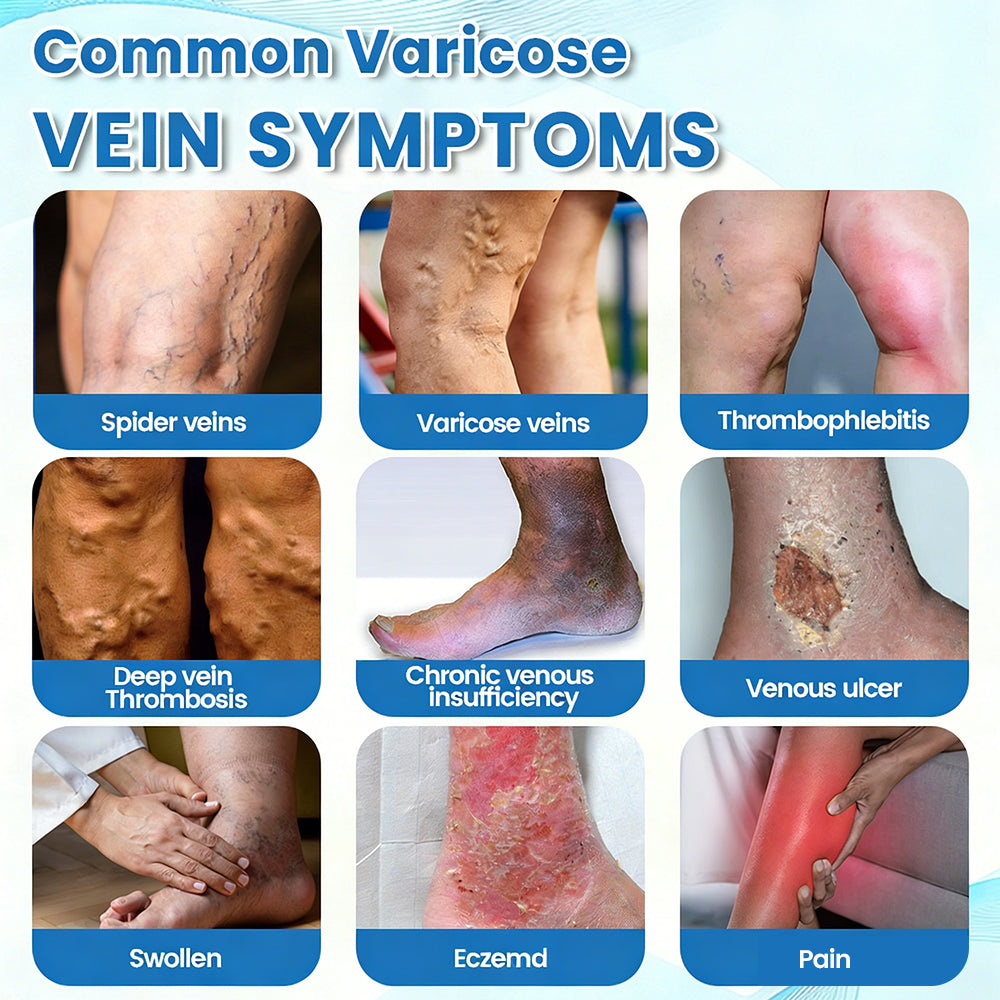 🇨🇦✅✅GFOUK® VascuCare Vein Healing Spray(Designed for Varicose veins, Spider veins, Deep vein Thrombosis, Chronic venous insufficiency, Venous ulcers, Thrombophlebitis and other venous issues)
