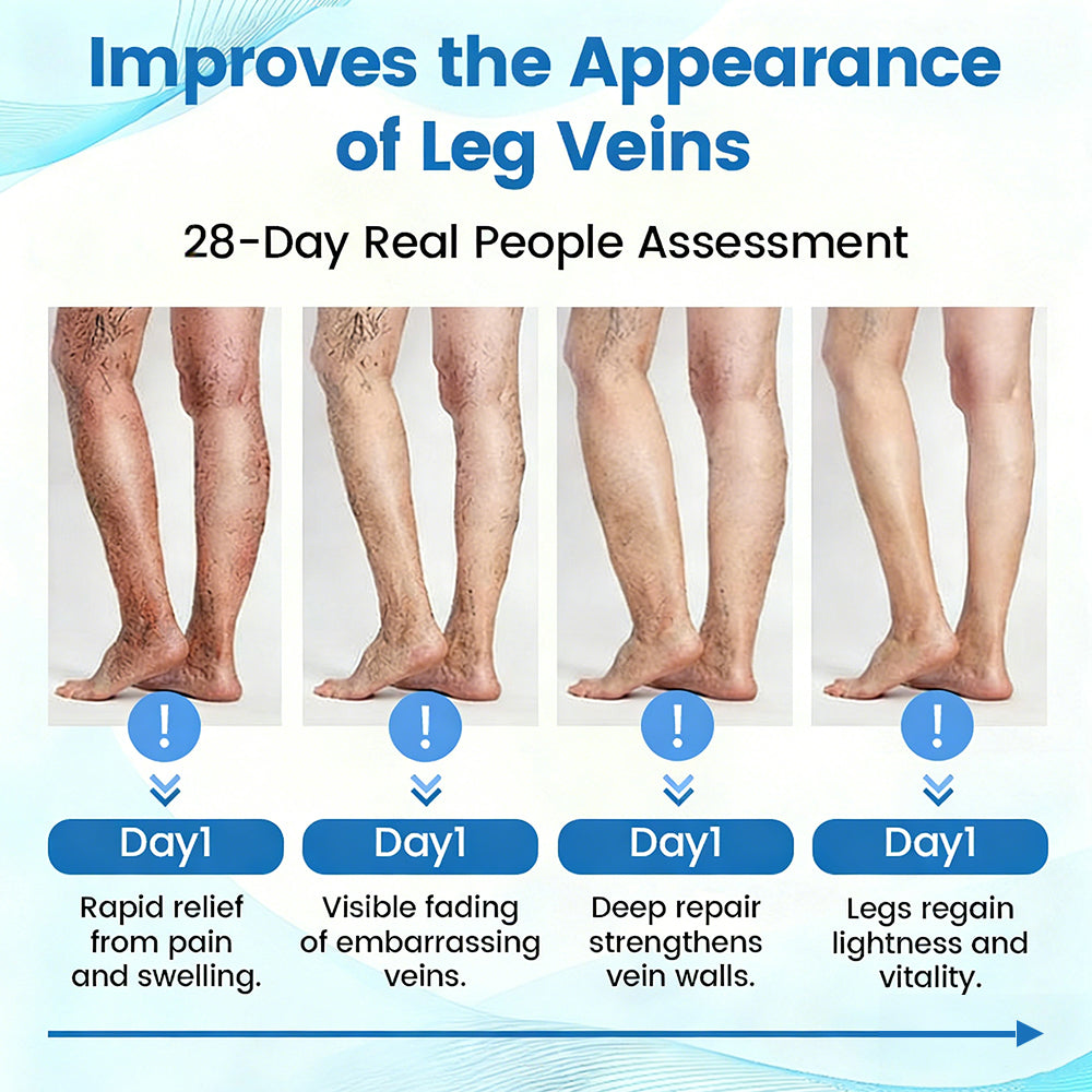 🇨🇦✅✅GFOUK® VascuCare Vein Healing Spray(Designed for Varicose veins, Spider veins, Deep vein Thrombosis, Chronic venous insufficiency, Venous ulcers, Thrombophlebitis and other venous issues)