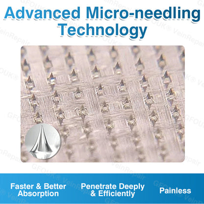 🇨🇦👨‍⚕️👨‍⚕️✅GFOUK® VeinRepair Microneedle Patch Roll⚡Instant Relief, Long-Term Results