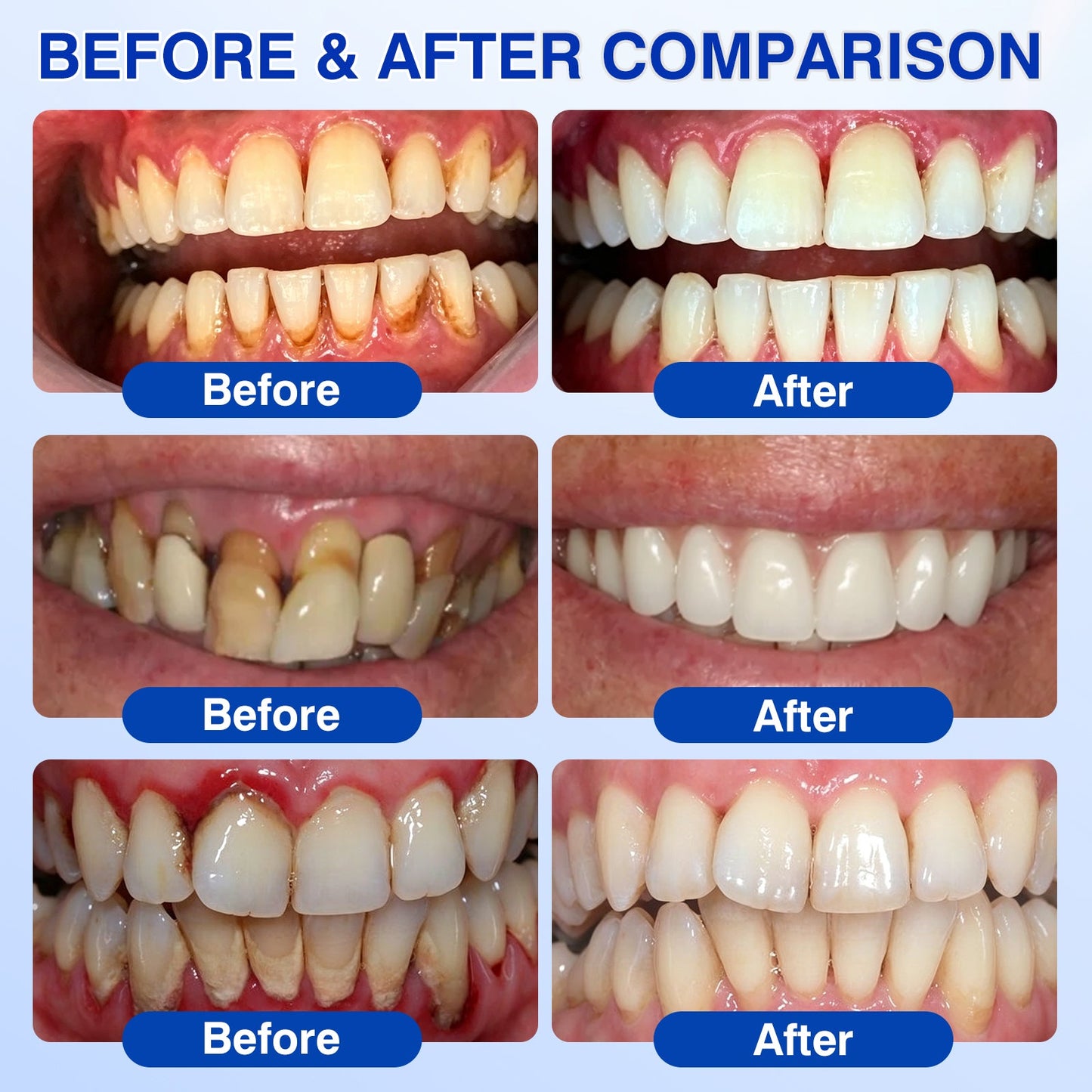 🇨🇦👨‍⚕️✅😁Evolvion® GumRevive Periodontal Repair Gel
