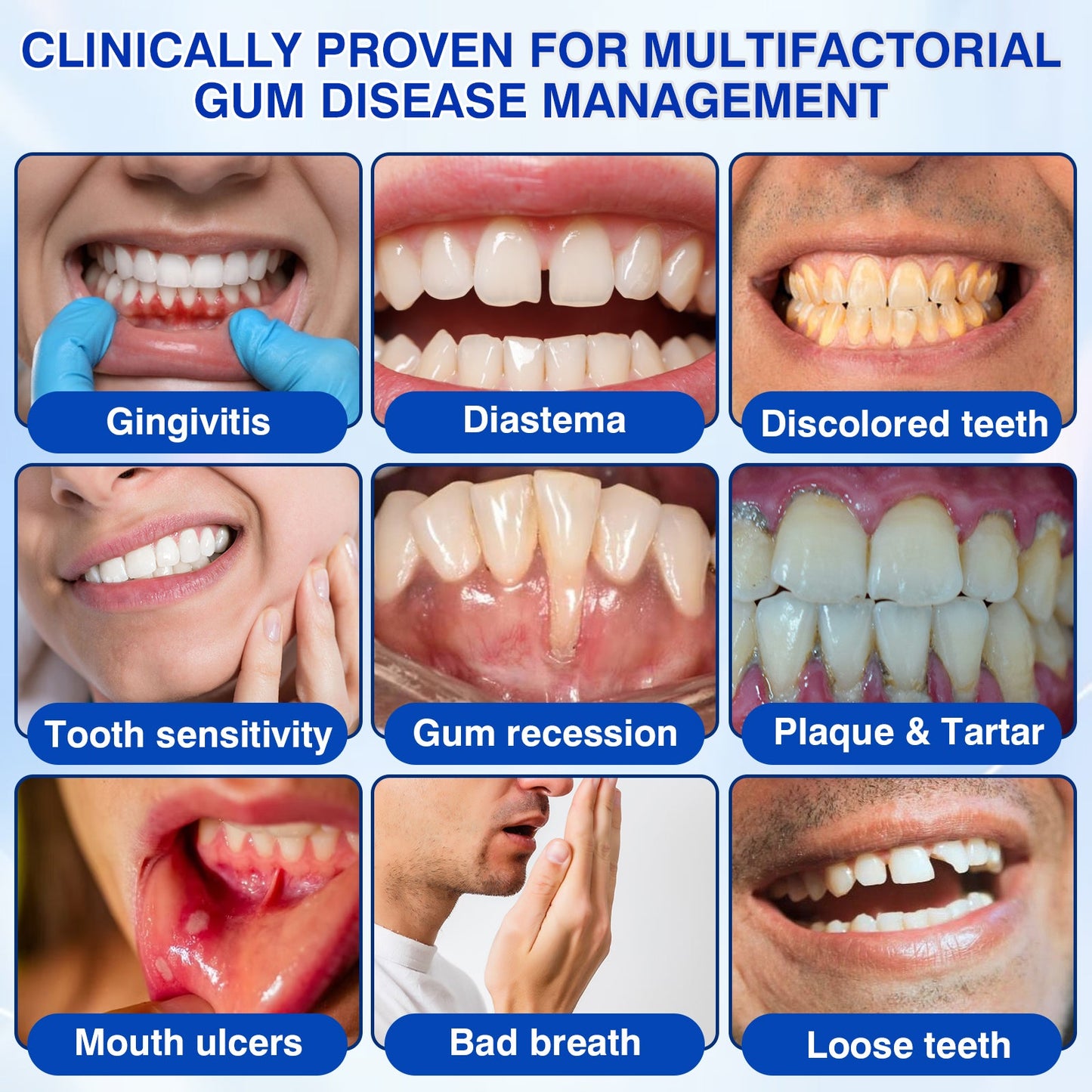 🇨🇦👨‍⚕️✅😁Evolvion® GumRevive Periodontal Repair Gel