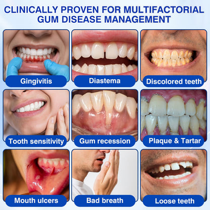 🇨🇦👨‍⚕️✅😁Evolvion® GumRevive Periodontal Repair Gel