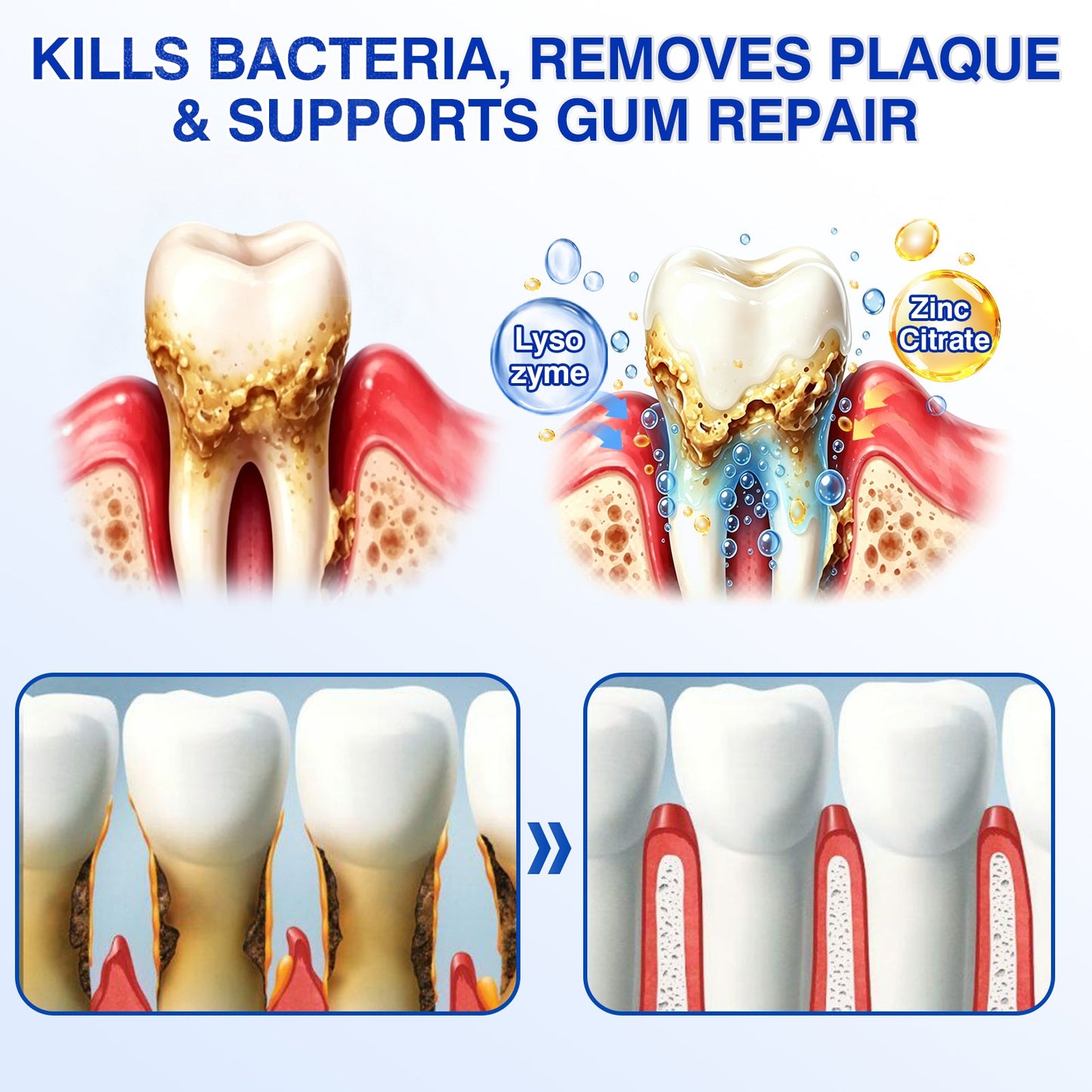 🇨🇦👨‍⚕️✅😁Evolvion® GumRevive Periodontal Repair Gel