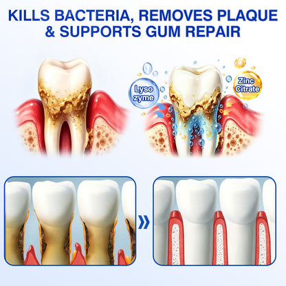 🇨🇦👨‍⚕️✅😁Evolvion® GumRevive Periodontal Repair Gel