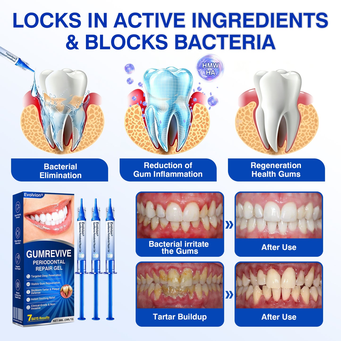 🇨🇦🏆✅🦷Evolvion® GumRevive Periodontal Repair Gel