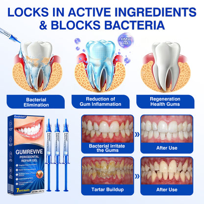 🇨🇦🏆✅🦷Evolvion® GumRevive Periodontal Repair Gel