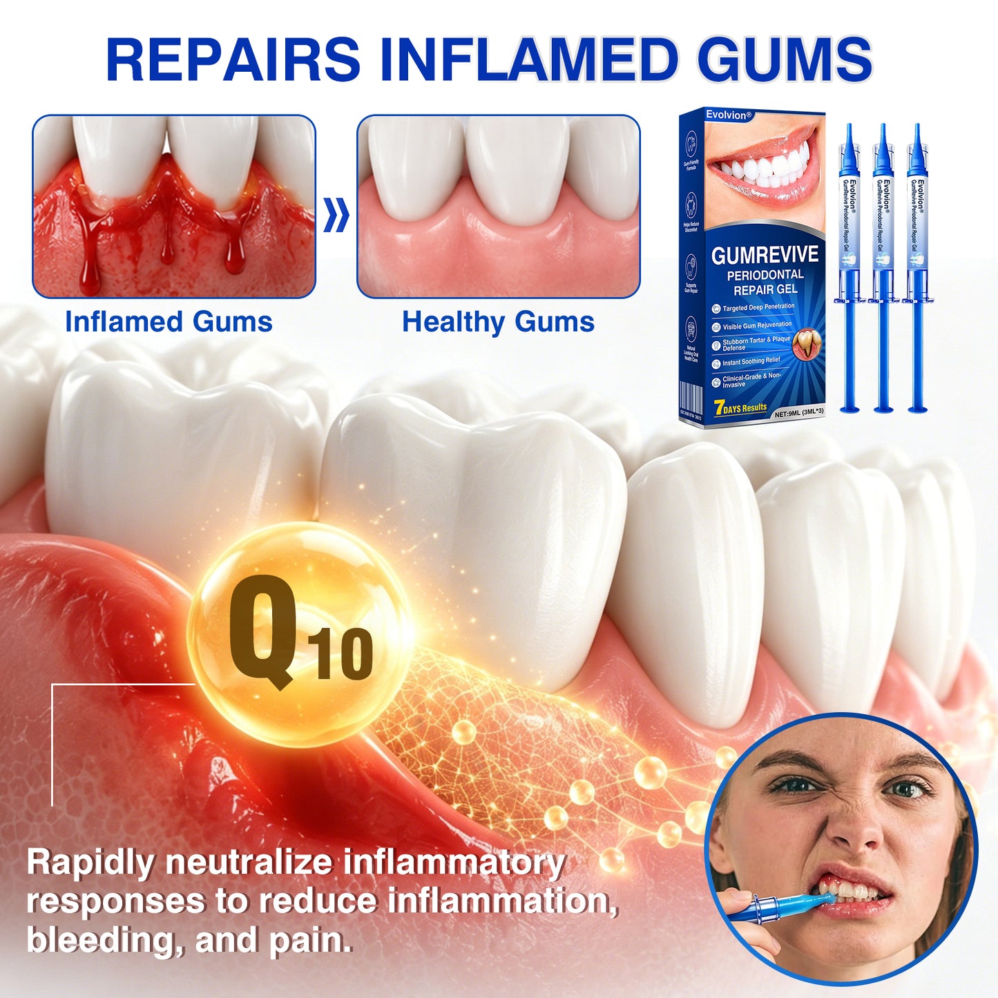 🇨🇦🏆✅🦷Evolvion® GumRevive Periodontal Repair Gel