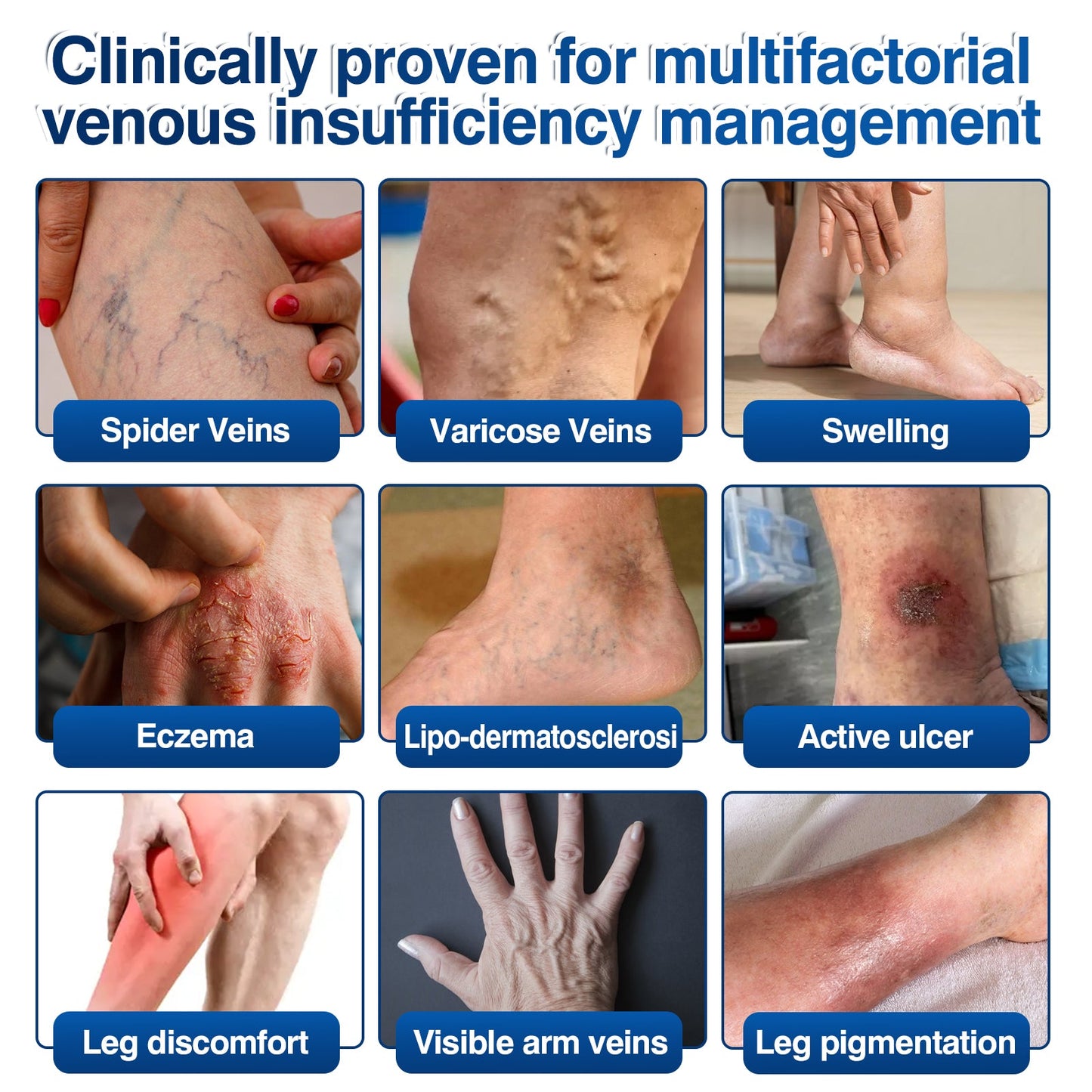 ca👨‍⚕️🦵🛡️GFOUK® VeinRenew Microneedle Balm