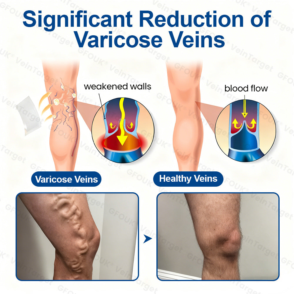 🇨🇦💙👨‍⚕️✅GFOUK® VeinTarget Microneedle Patch⚡Instant Relief, Long-Term Results